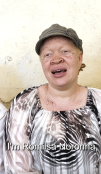 Interview to people with Albinism